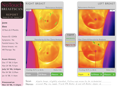 infrared breast scan